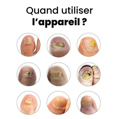 Appareil Anti-Mycose